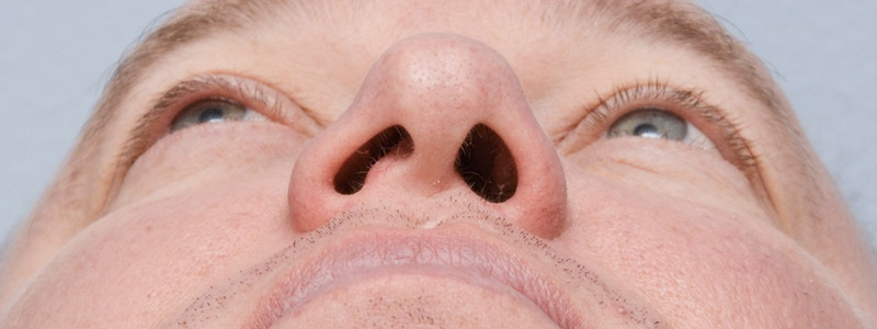 Before-Reconstrucción nasal