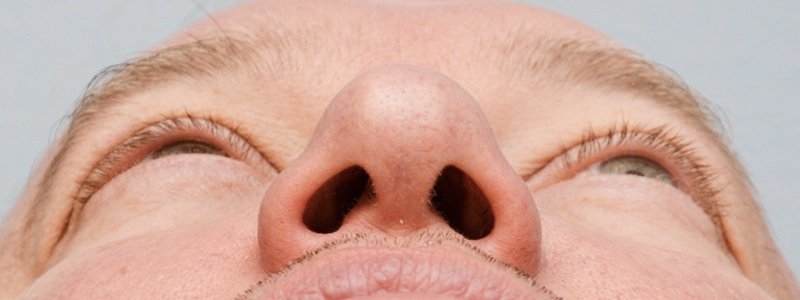 After-Reconstrucción nasal