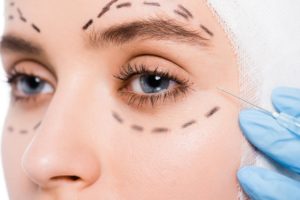 Blefaroplastia