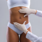 Diferencia entre abdominoplastía y liposucción